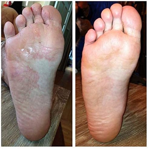 Advanced Foot & Shoe Deodorizer Spray (150ml) - Promotes Healthy Nails & Toenail Condition - Athletes Foot Shoe Spray for Fungal Treatment | Anti Toe Fungus Treatment and Foot Fungus | 150 ML